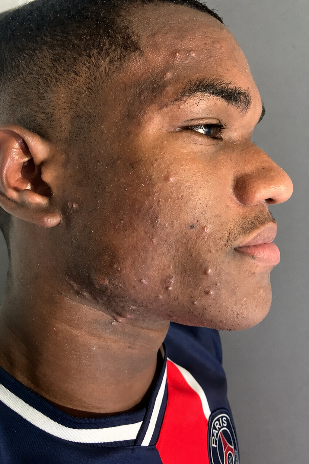 Skin consultation at The Skin Lab Jamaica