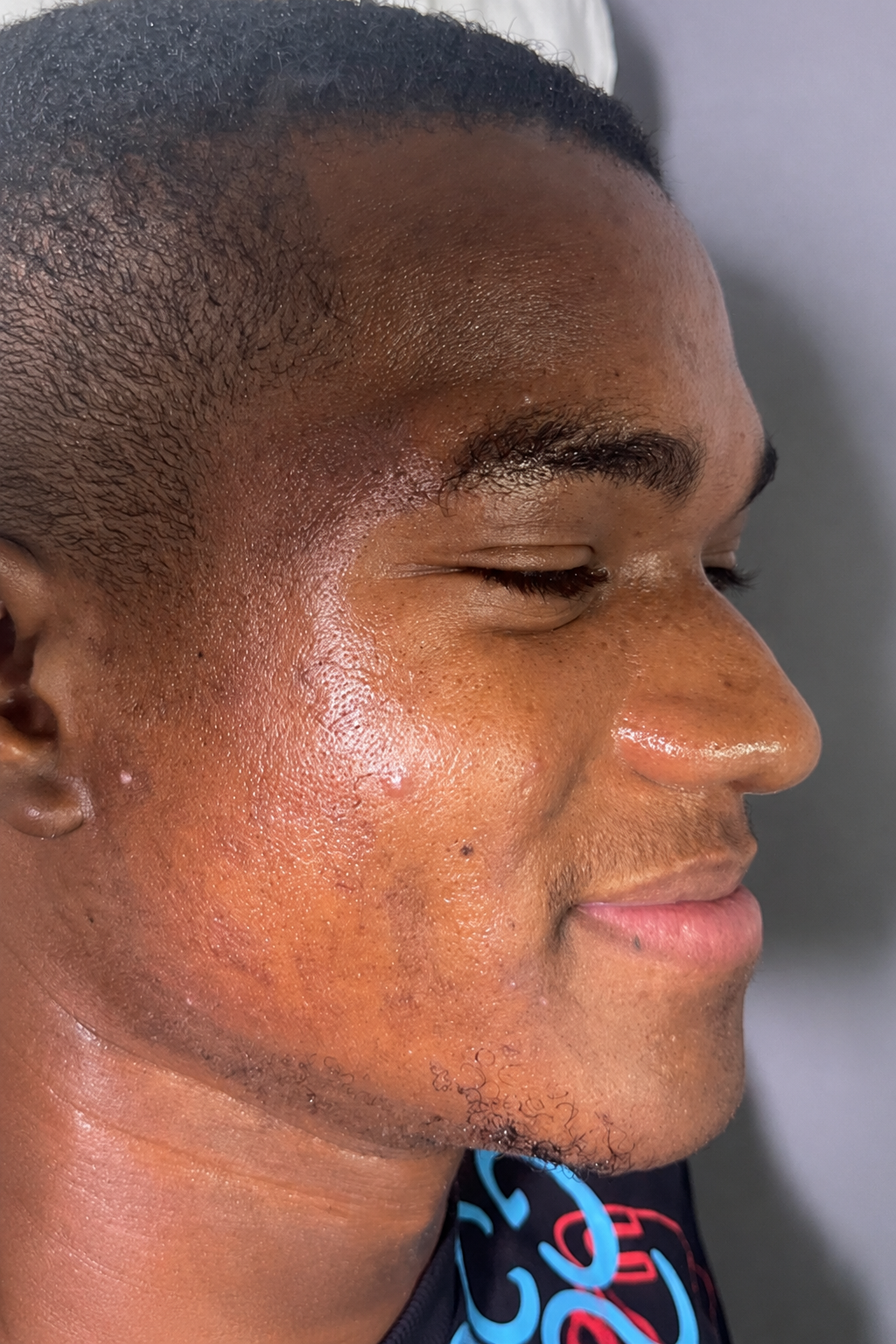 Professional skin care consultation